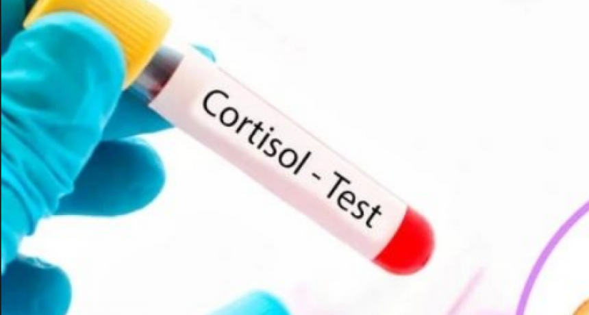 ¿Cómo hacemos el diagnóstico de Sindrome de Cushing?