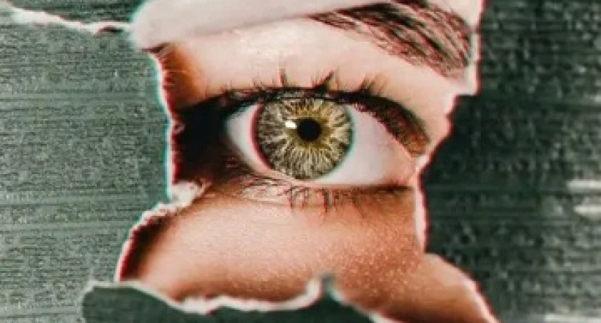 La oftalmopatía tiroidea u oftalmopatía de Graves es una manifestación común del hipertiroidismo autoinmune