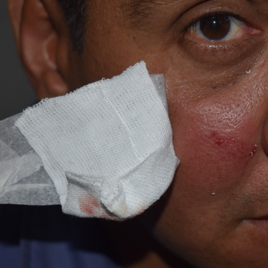 Jóvenes atacaron con gomeras y lesionaron a un policía