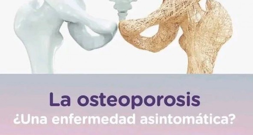La Osteoporosis ¿Una enfermedad asintomática ?