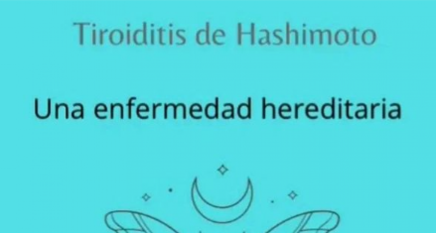 Tiroiditis de Hashimoto